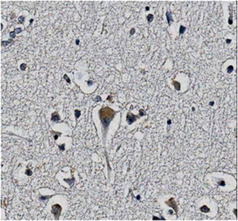 Anti-KChIP2 potassium channel subunit Antibody, clone 60/73 | MABN371