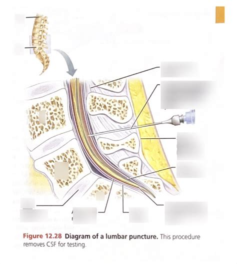 Image result for Spinal Tap Stumpy