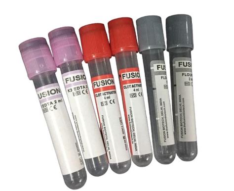 Non Vacuum Blood Collection Tube Laboratory & Hospital Use, Best Price ...