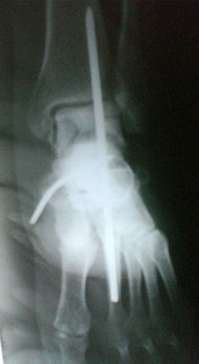 foot & ankle associates