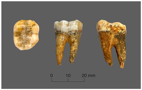Measuring Dental Enamel Thickness: Morphological and Functional ...