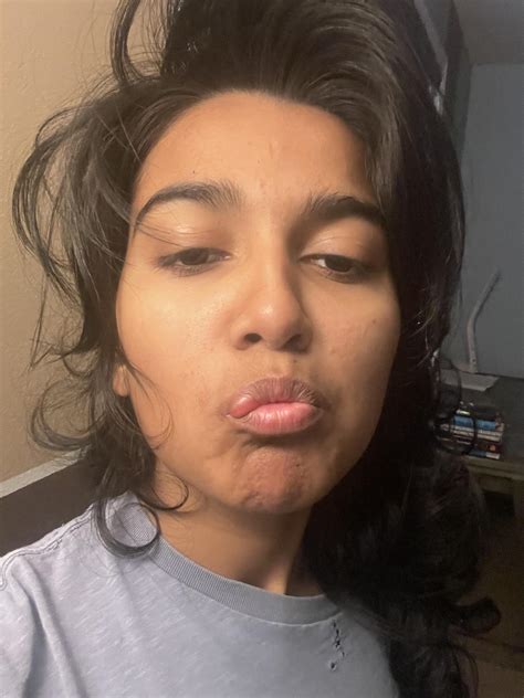 Got this strange bump on my lip after eating spicy stuff : r/Weird