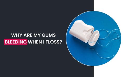 Why are my Gums Bleeding When I Floss?