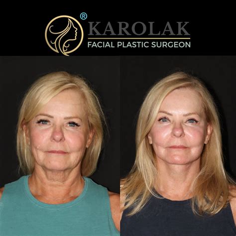 Dr. Mark Karolak, DO, FAOCO | Here’s an update on one of my patients that I posted a few weeks ...