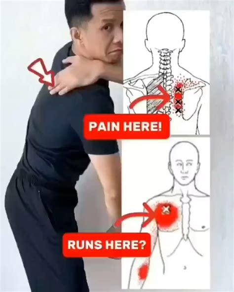 Image result for Scapular Mobilization Exercises