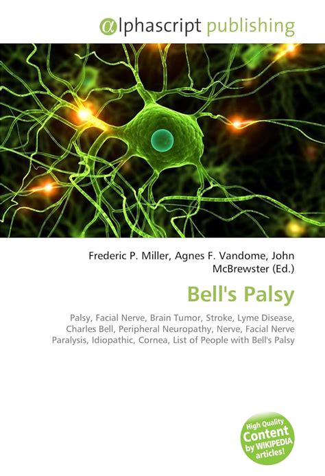 Bell''s Palsy : Amazon.in: Books