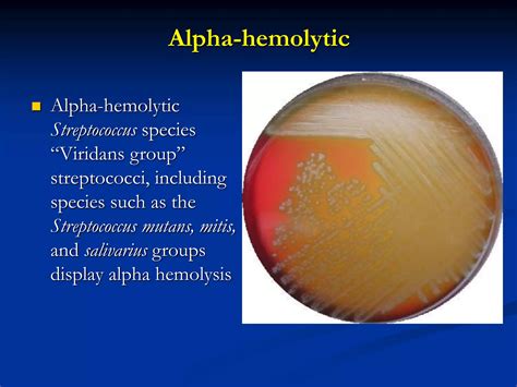 4 blood agar and hemolysis and mac-conkey.ppt