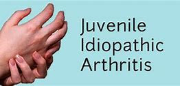 Image result for Juvenile Arthritis Symptoms