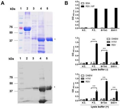 Development of a Rapid Fluorescent Immunochromatographic Test to Detect ...