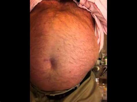 Tummy Exploded 的图像结果