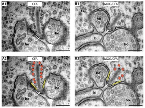IJMS | Special Issue : Ribbon Synapses: Molecular Mechanisms of ...