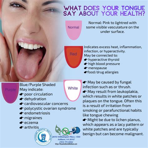 What does your tongue say about your health? The color of your tongue can tell us more than you ...