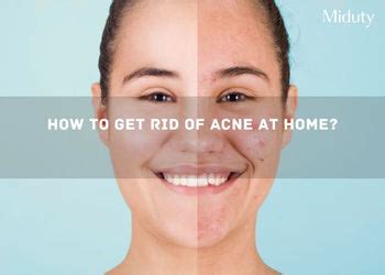 6 Ways to do Acne Treatment at Home - Miduty