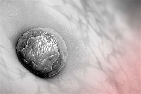 IVF Procedure Explained 的图像结果