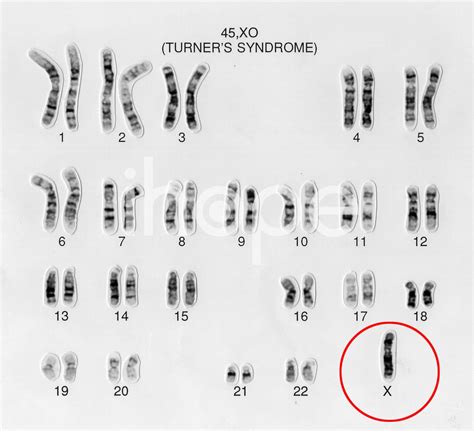 Thay đổi số lượng nhiễm sắc thể ảnh hưởng thế nào?