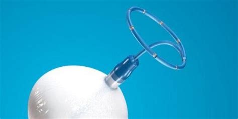 ETMC among first hospitals to offer new way to treat common form of ...