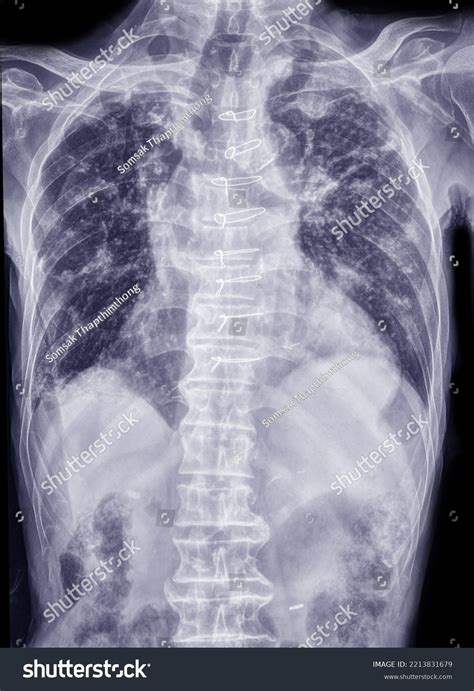 X Rays Tube: Over 1,349 Royalty-Free Licensable Stock Photos | Shutterstock