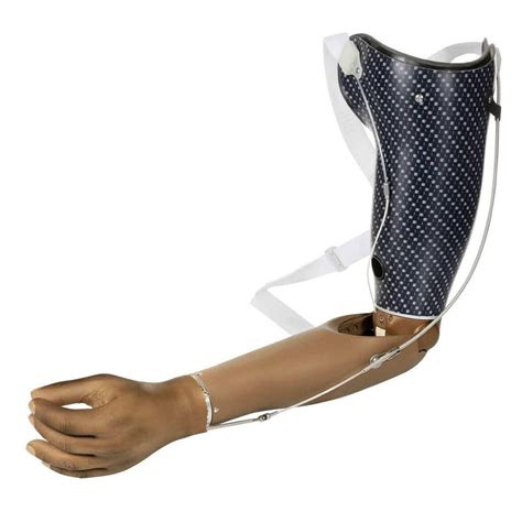 Body Powered Prosthesis