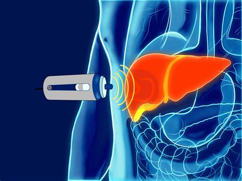 What Is FibroScan? A Helpful Guide To Your Liver Health - Scan Clinic ...