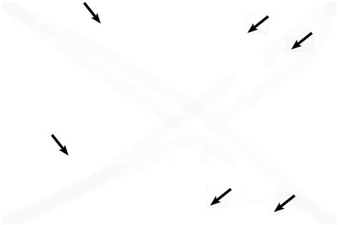 Intramembranous 2 | Digital Histology