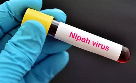 No fresh Nipah positive cases, 42 more negative results: Kerala govt