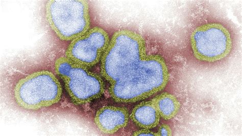 Pune: 73-year-old man dies due to H3N2 virus in Pimpri Chinchwad