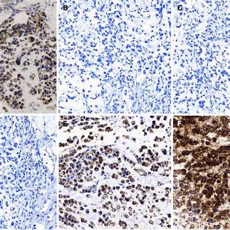 Image result for IHC Staining