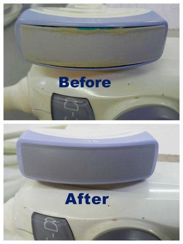 Service For Convex Transducer Replacement