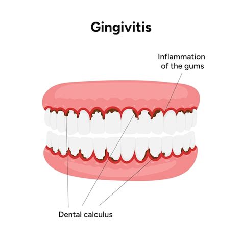 Page 6 | Missing teeth adult Vectors - Download Free High-Quality ...
