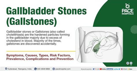 Gallstones Gallbladder Stones Symptoms Causes - Health, Beauty ...