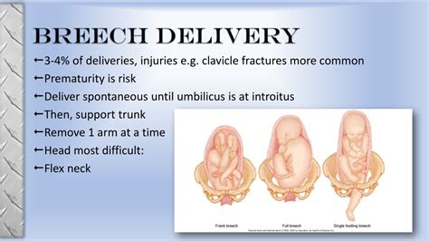 PPT - OB EMS E mergencies Presented by Jodi McGraw, M.D. PowerPoint ...