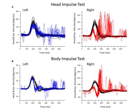 Impulse Control Test 的图像结果