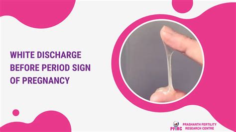 White Discharge Before Period Symptom White Discharge Before Period