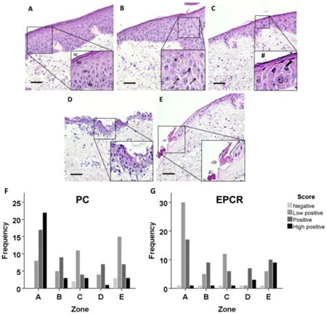 Epidermal Protein C Levels Correspond to Local Injury Severity and ...