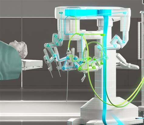 Image result for Computer Assisted Surgery