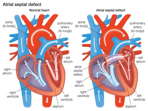 Interatrial Septum