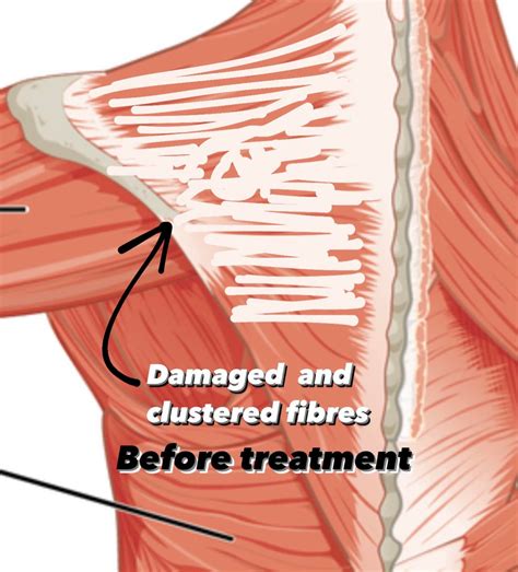 Image result for Bodybuilder Deep Tissue