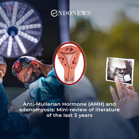 Adenomyosis and the anti-mullerian hormone levels | EndoNews