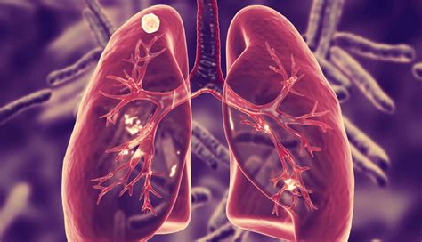 Top 10 Major Causes of Death, As Per WHO Report - lifeberrys.com