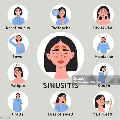 Ilustración de Mujer Joven Con Síntomas De Sinusitis Y Signos Tempranos Mujer Con Fiebre ...