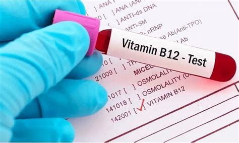 Redcliffe Labs Cost Effective Vitamin D And B12 Test Price - Health ...