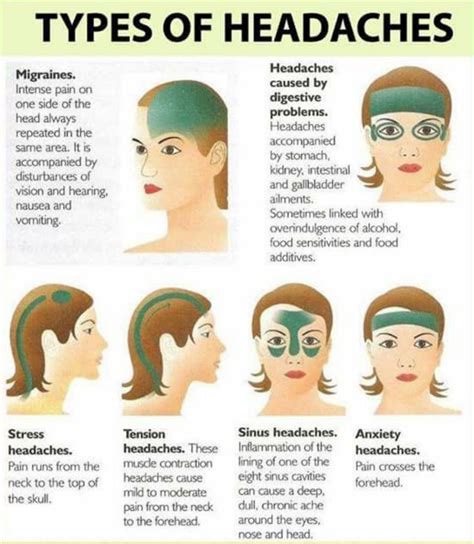 Migraine Remedies That Really Work | Headache types, Migraines remedies, Headache remedies