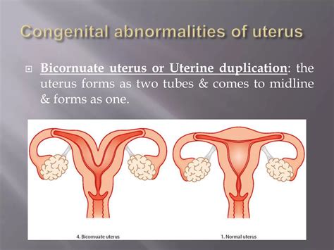 Image result for Female Reproductive System Disorders