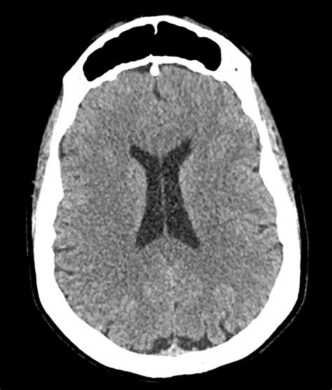 Image result for Scanner Cerebral Avec Injection Diode