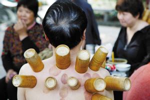 宁波市康复医院 特色诊疗 吞咽障碍的康复治疗