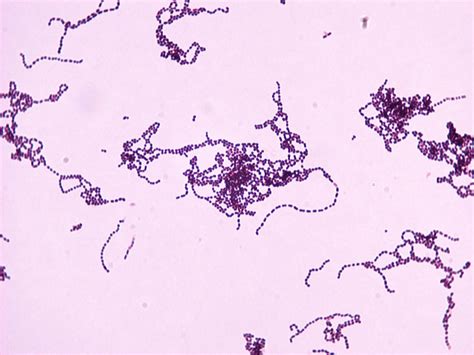 Image result for Staphylococcus Saprophyticus Infection