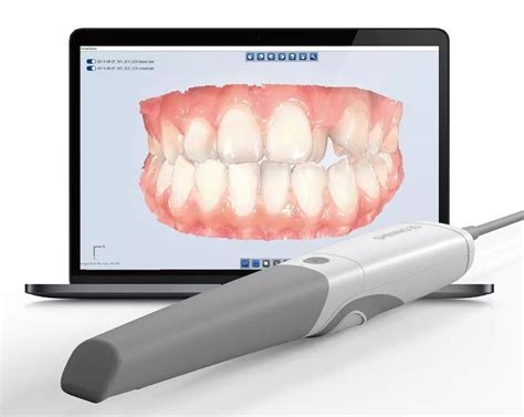 Ambient light illuminance for Intraoral scanner may maximize scanning ...