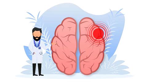 Image result for Brain Decimation