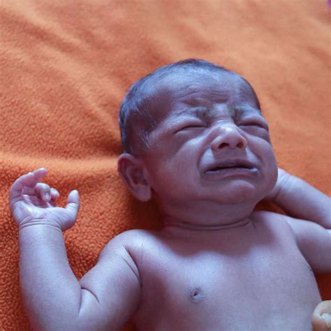 A Case Report of Acquired Methemoglobinemia in a Neonate Complicated by ...