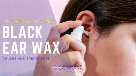 Understanding Black Ear Wax: Causes and Treatments – discountdailyhearing